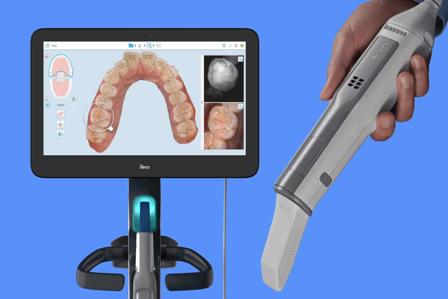 Scanner iTero® Element em uso clínico