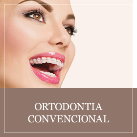 Ortodontia Convencional